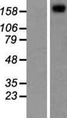 Western Blot: TRPM3 Overexpression Lysate [NBP2-06581]