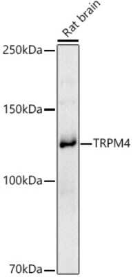 Western Blot: TRPM4 AntibodyAzide and BSA Free [NBP2-93270]