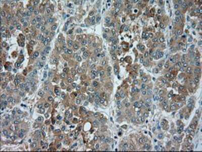 Immunohistochemistry-Paraffin: TRPM4 Antibody (OTI10H5) [NBP1-48036]