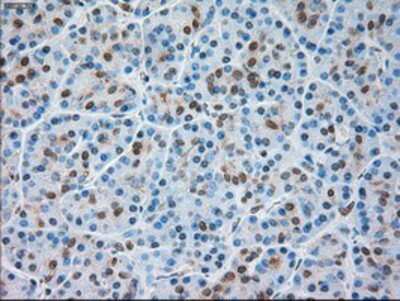 Immunohistochemistry-Paraffin: TRPM4 Antibody (OTI10H5) [NBP1-48036]