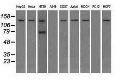 Western Blot: TRPM4 Antibody (OTI10H5) [NBP1-48036]