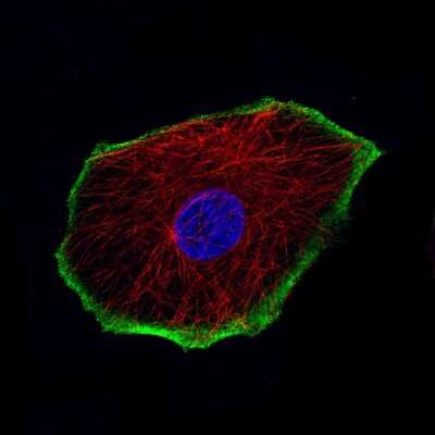 Immunocytochemistry/ Immunofluorescence: TRPM4 Antibody (CL11214) [NBP3-07990]