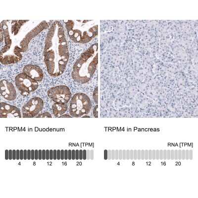 Immunohistochemistry-Paraffin: TRPM4 Antibody (CL11214) [NBP3-07990]