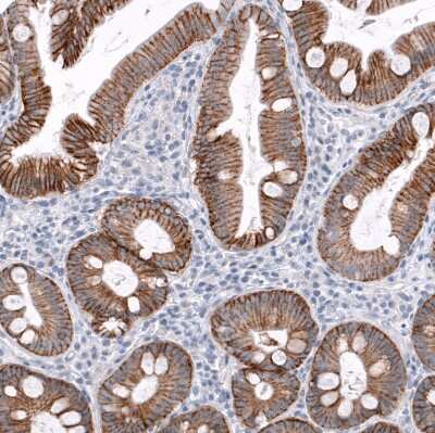 Immunohistochemistry-Paraffin: TRPM4 Antibody (CL11214) [NBP3-07990]