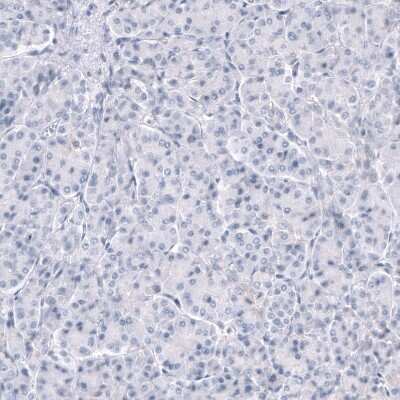 Immunohistochemistry-Paraffin: TRPM4 Antibody (CL11214) [NBP3-07990]