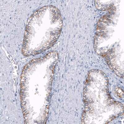 Immunohistochemistry-Paraffin: TRPM4 Antibody (CL11214) [NBP3-07990]