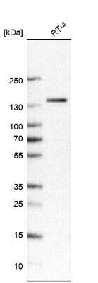 Western Blot: TRPM4 Antibody (CL11214) [NBP3-07990]