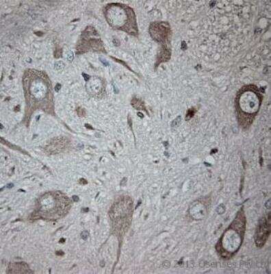 Immunohistochemistry-Paraffin: TRPM4 Antibody [NB110-74949]