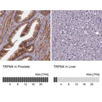 Immunohistochemistry-Paraffin: TRPM4 Antibody [NBP2-13487]