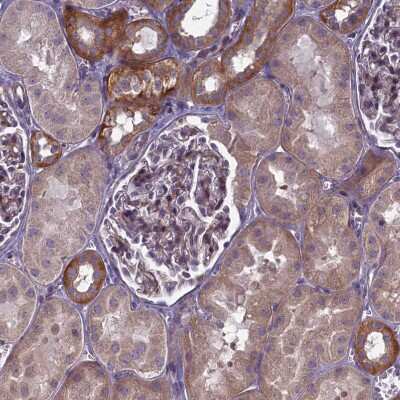 Immunohistochemistry-Paraffin: TRPM4 Antibody [NBP2-13487]