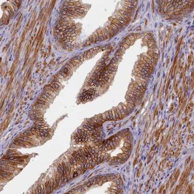 Immunohistochemistry-Paraffin: TRPM4 Antibody [NBP2-13487]