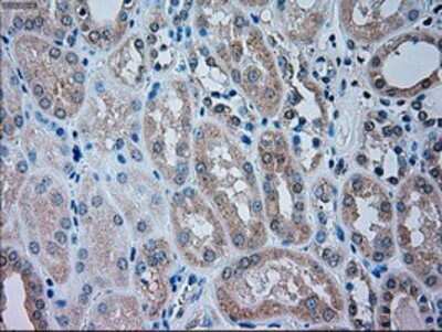 Immunohistochemistry: TRPM4 Antibody (OTI10H5) - Azide and BSA Free [NBP2-74647]