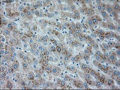 Immunohistochemistry: TRPM4 Antibody (OTI10H5) - Azide and BSA Free [NBP2-74647]