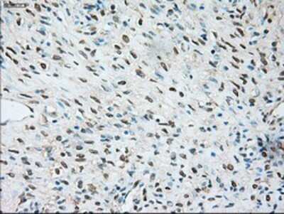 Immunohistochemistry: TRPM4 Antibody (OTI10H5) - Azide and BSA Free [NBP2-74647]