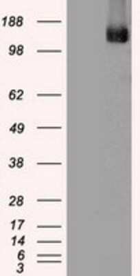 Western Blot: TRPM4 Antibody (OTI10H5)Azide and BSA Free [NBP2-74647]