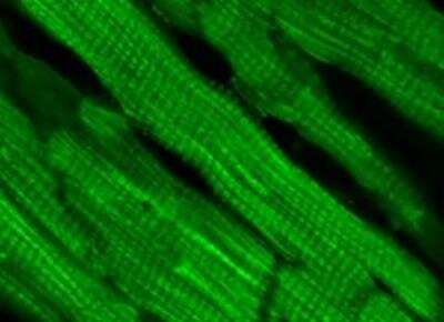 Immunohistochemistry: TRPM4 Antibody (OTI10H5) [NBP1-48036]