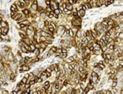 Immunohistochemistry-Paraffin: TRPM4 Antibody (OTI10H5) [NBP1-48036]