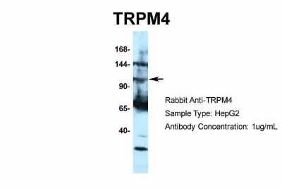 Western Blot: TRPM4 Antibody [NBP2-88492]