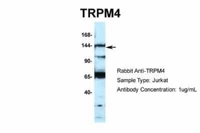 Western Blot: TRPM4 Antibody [NBP2-88492]
