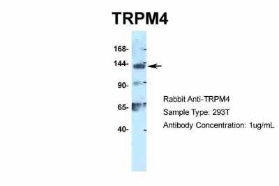 Western Blot: TRPM4 Antibody [NBP2-88492]