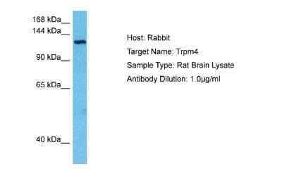 Western Blot: TRPM4 Antibody [NBP2-88492]