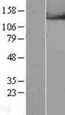 Western Blot: TRPM4 Overexpression Lysate [NBL1-17336]