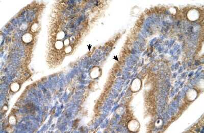 Immunohistochemistry: TRPM5 Antibody [NBP2-88494]