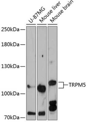 Western Blot: TRPM5 AntibodyAzide and BSA Free [NBP2-94006]