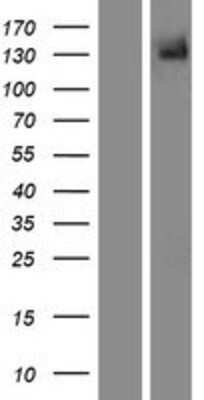 Western Blot: TRPM5 Overexpression Lysate [NBP2-07318]