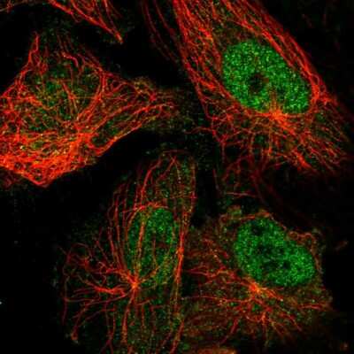 Immunocytochemistry/ Immunofluorescence: TRPM7 Antibody [NBP2-58525]