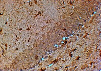 Immunohistochemistry-Paraffin: TRPM7 Antibody [NB100-810]