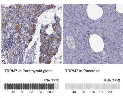 Immunohistochemistry-Paraffin: TRPM7 Antibody [NBP2-58525]