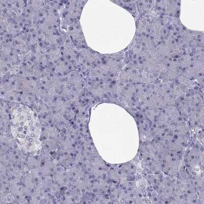 Immunohistochemistry-Paraffin: TRPM7 Antibody [NBP2-58525]