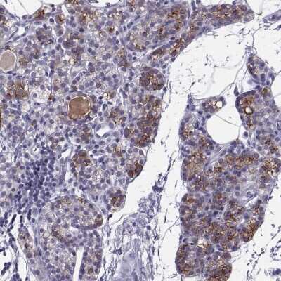 Immunohistochemistry-Paraffin: TRPM7 Antibody [NBP2-58525]