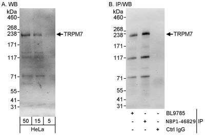 Immunoprecipitation: TRPM7 Antibody [NBP1-46829]