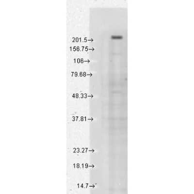 Western Blot: TRPM7 Antibody (S74) [NBP2-12906]