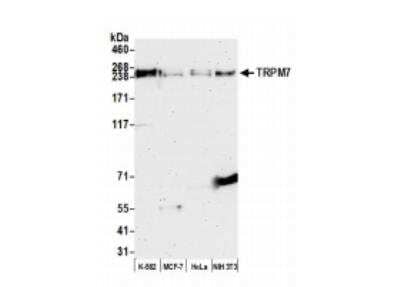 Western Blot: TRPM7 Antibody [NBP1-46829]