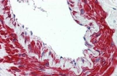 Immunohistochemistry-Paraffin: TRPM8 Antibody [NBP3-14506]