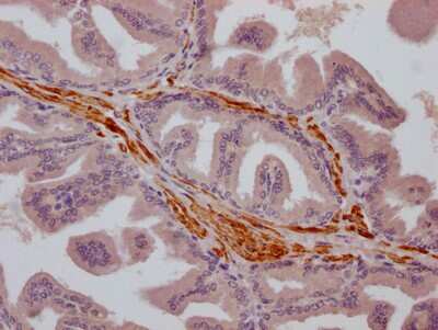 Immunohistochemistry: TRPM8 Antibody (2G7) [NBP3-15183]