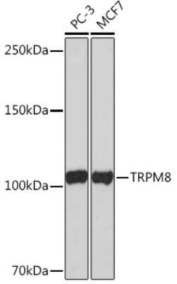 Western Blot: TRPM8 Antibody (9S8N1) [NBP3-16366]