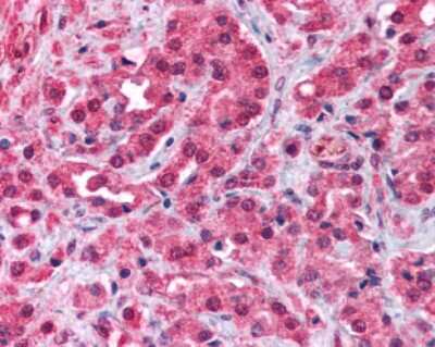 Immunohistochemistry: TRPM8 Antibody - BSA Free [NB200-145]