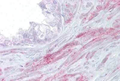 Immunohistochemistry: TRPM8 Antibody [NBP3-10364]