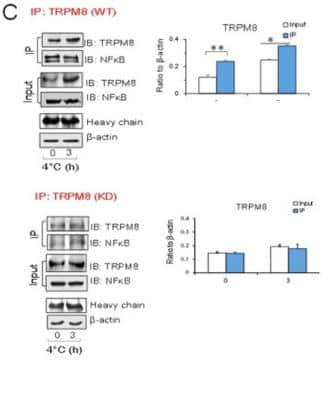 Knockdown Validated: TRPM8 Antibody - BSA Free [NBP1-97311]