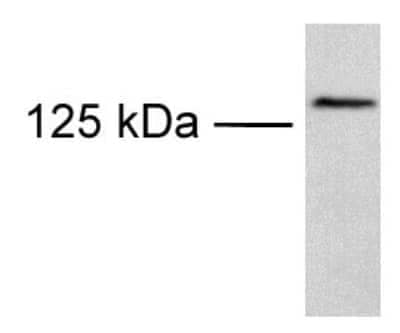 Western Blot: TRPM8 AntibodyBSA Free [NB200-145]