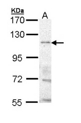 Western Blot: TRPM8 Antibody [NBP1-33165]