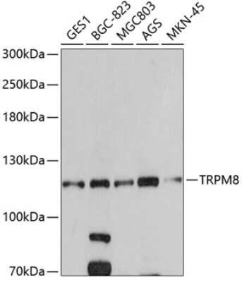 Western Blot: TRPM8 AntibodyBSA Free [NBP2-94139]