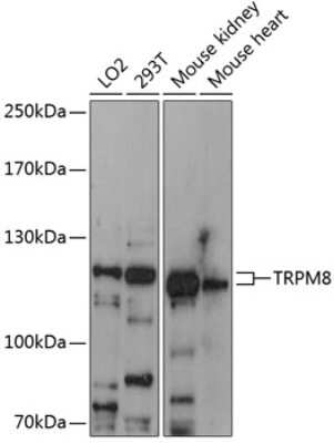 Western Blot: TRPM8 AntibodyAzide and BSA Free [NBP2-95133]