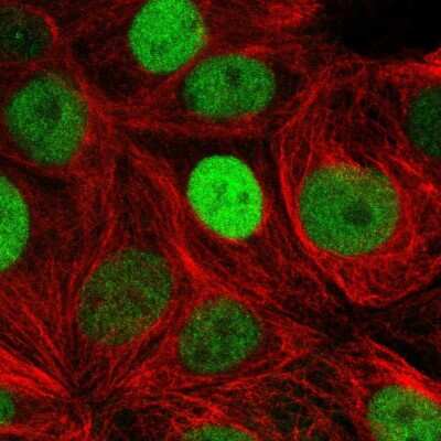 Immunocytochemistry/ Immunofluorescence: TRPS1 Antibody [NBP2-57025]