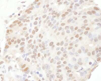 Immunohistochemistry: TRPS1 Antibody [NBP2-04120]