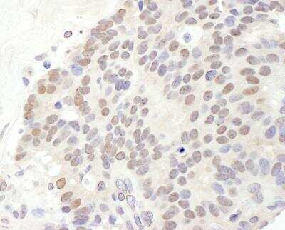 Immunohistochemistry-Paraffin: TRPS1 Antibody [NBP2-04082]